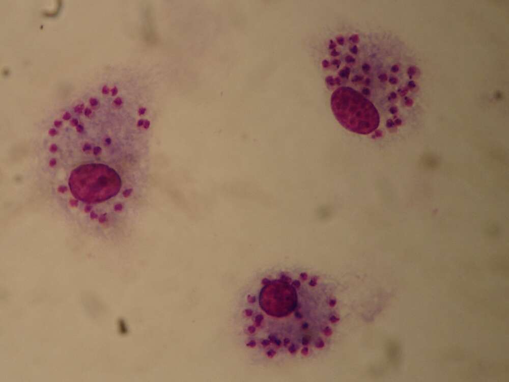 Image of Leishmania tropica