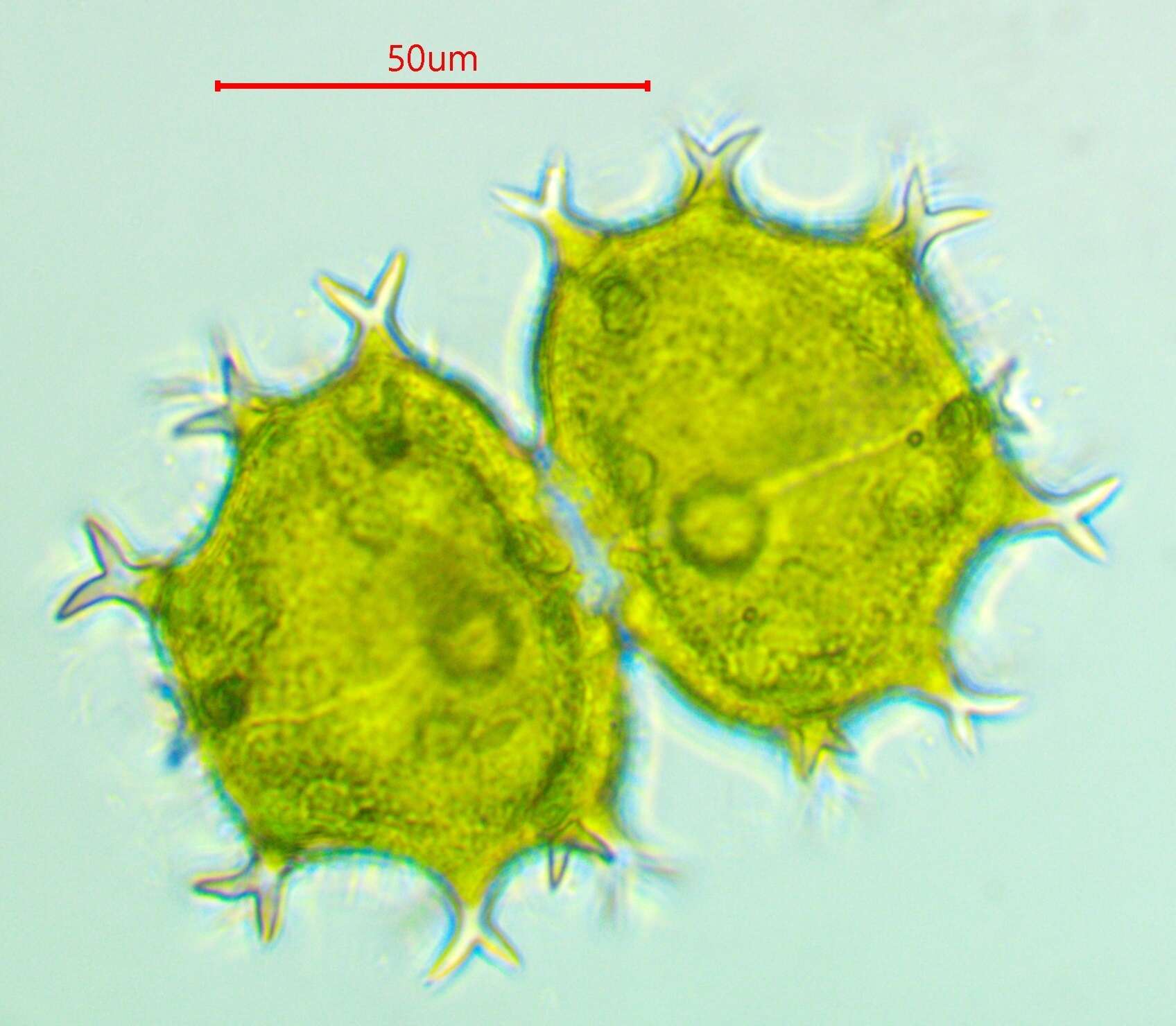 Image of Xanthidium armatum