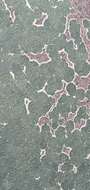 Image of wart lichen