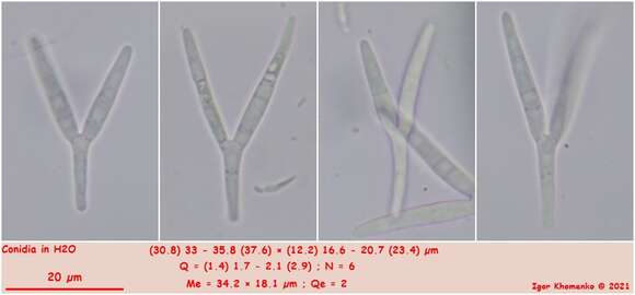 Image de Orbilia ficicola