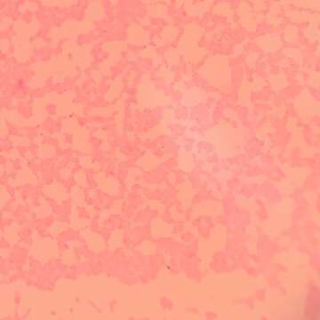 Image of Staphylococcus epidermidis