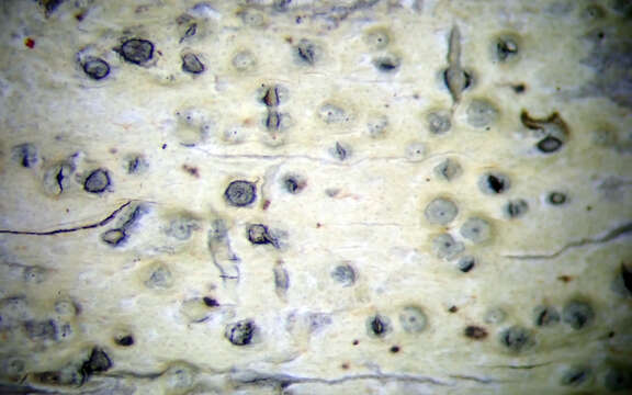 Image of wart lichen