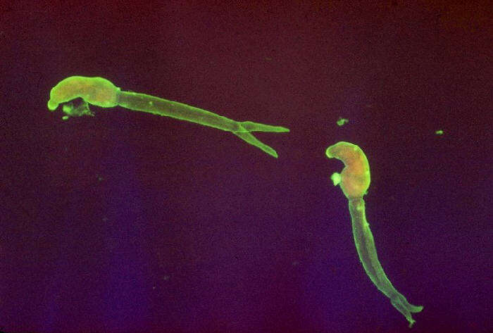 Image of Schistosoma mansoni