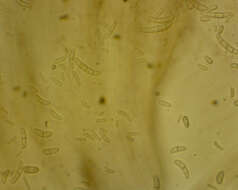 Image of Fusarium