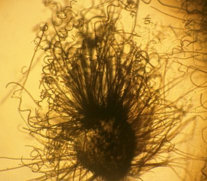Image of Chaetomium