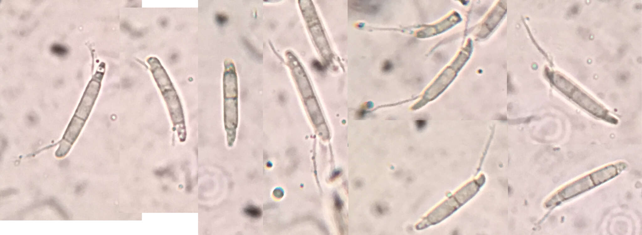 Discosia strobilina Lib. ex Sacc. 1884 resmi