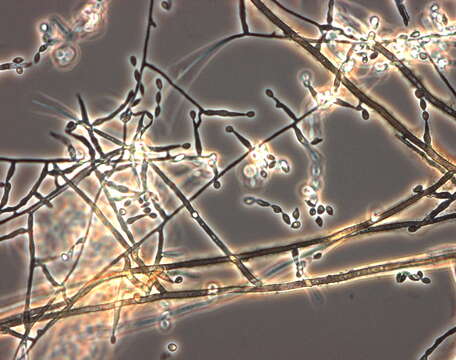 صورة Acrophialophora fusispora (S. B. Saksena) Samson 1970