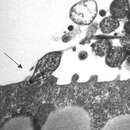 Image of Mycoplasma pneumoniae