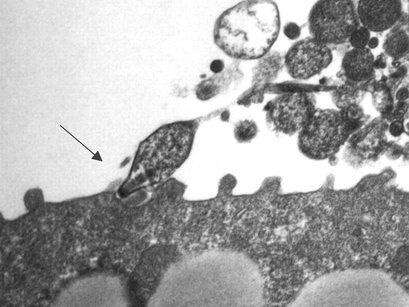 Image of Mycoplasma pneumoniae