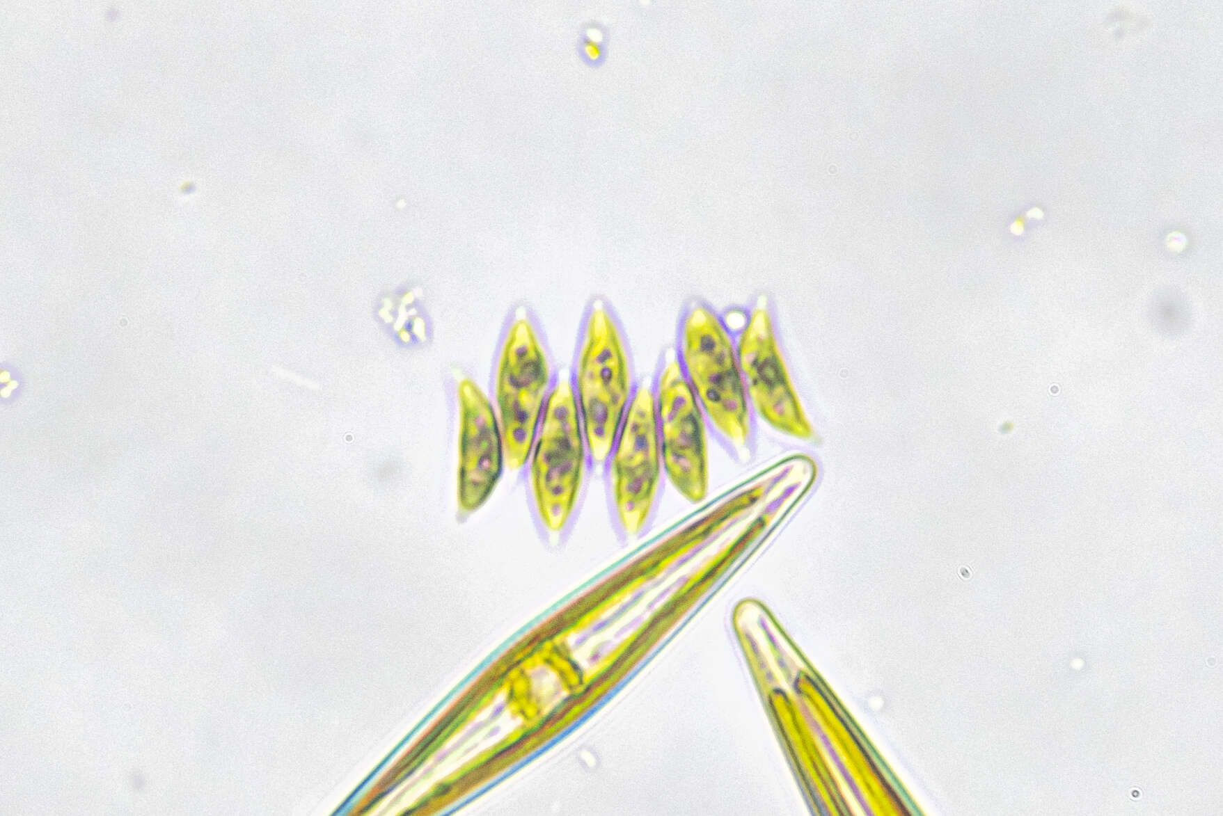 Plancia ëd Tetradesmus obliquus