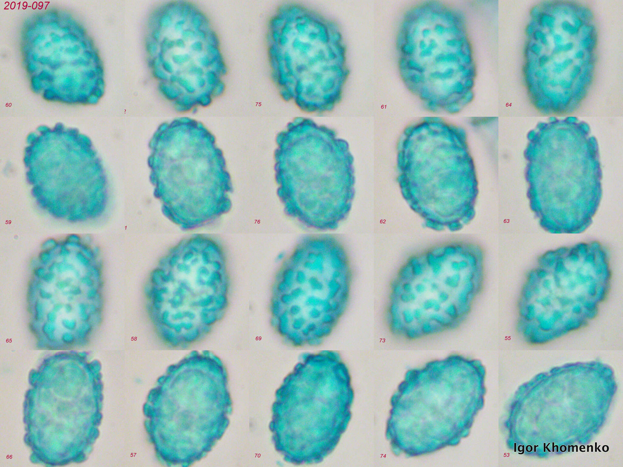 Scutellinia pennsylvanica (Seaver) Denison 1961 resmi