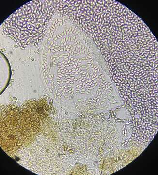 Imagem de Thelebolus stercoreus Tode 1790