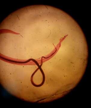 Imagem de Schistosoma mansoni