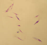 Image of Leishmania tropica