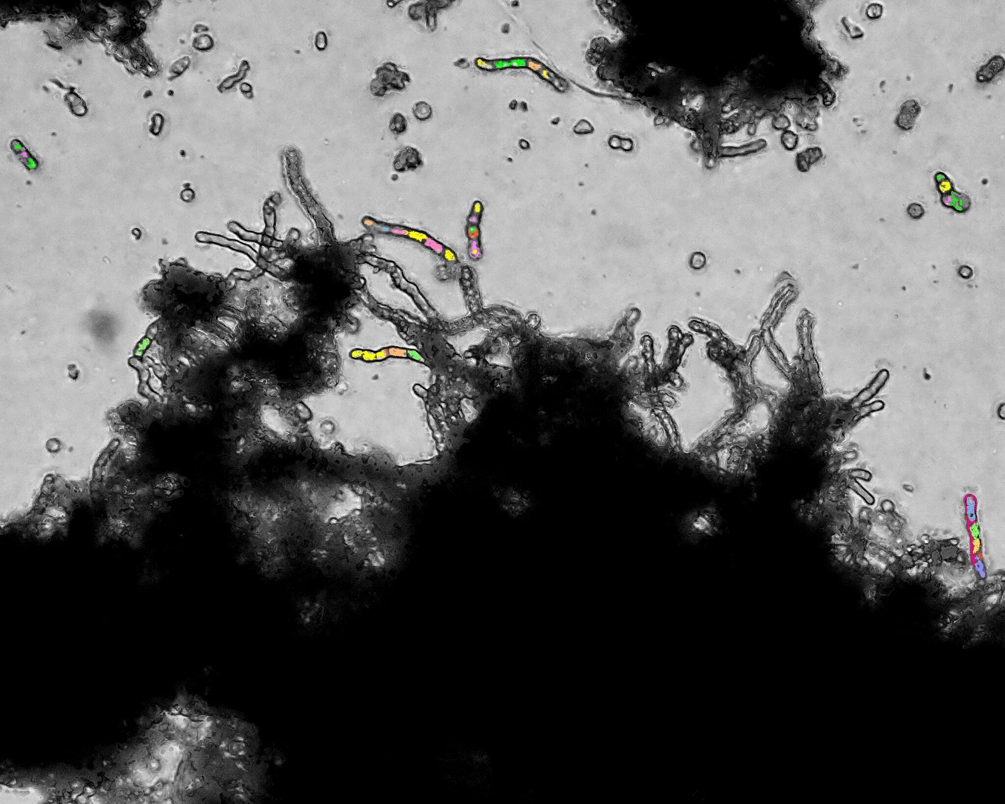 Image de Baudoinia compniacensis (Richon) J. A. Scott & Unter. 2007