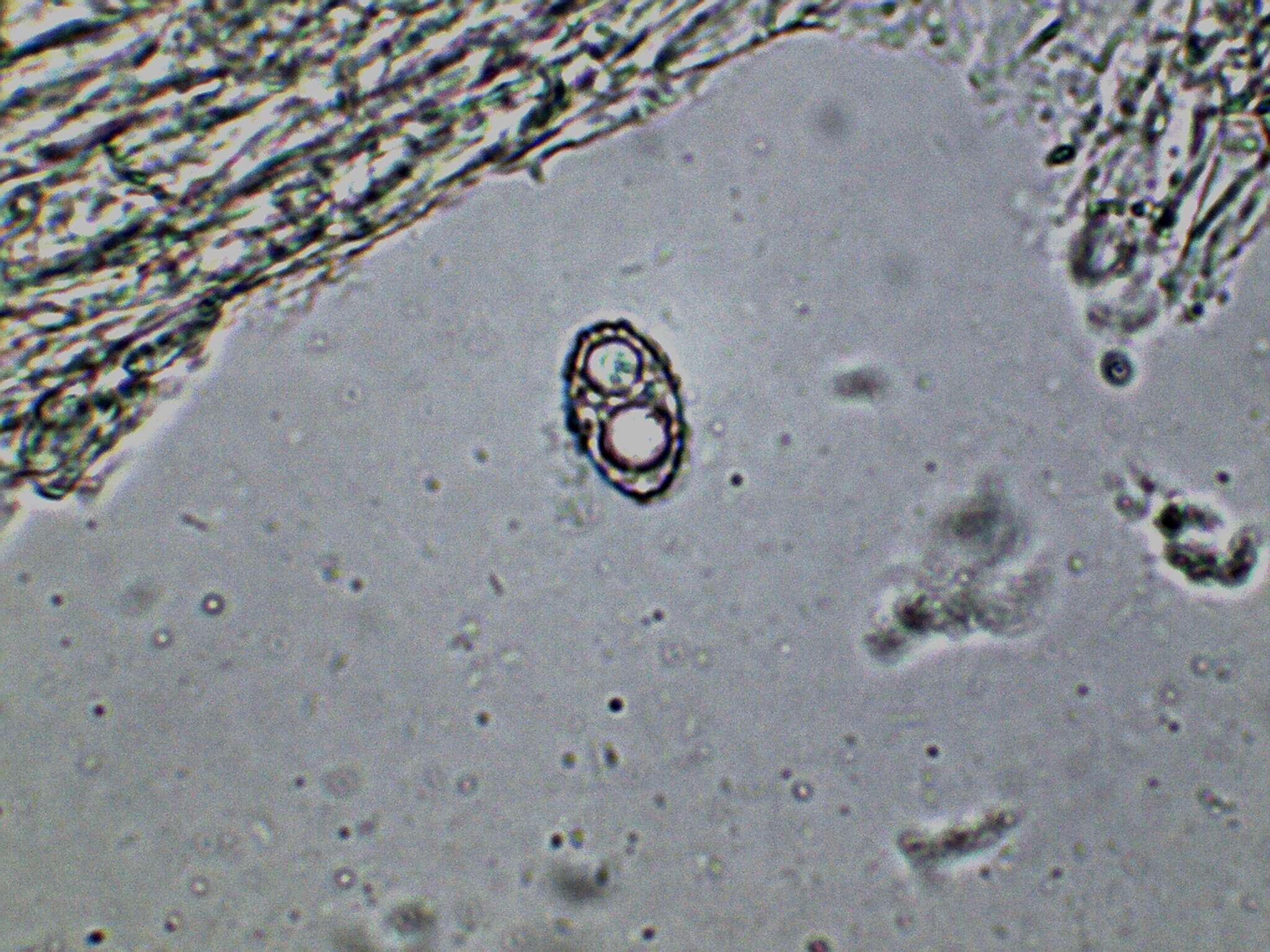 Imagem de Pachyella celtica (Boud.) Häffner 1993