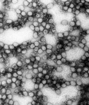 Image of Alphavirus