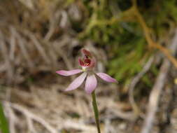 Image of White fingers