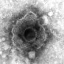 Image of Simplexvirus