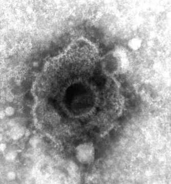 Image of Simplexvirus