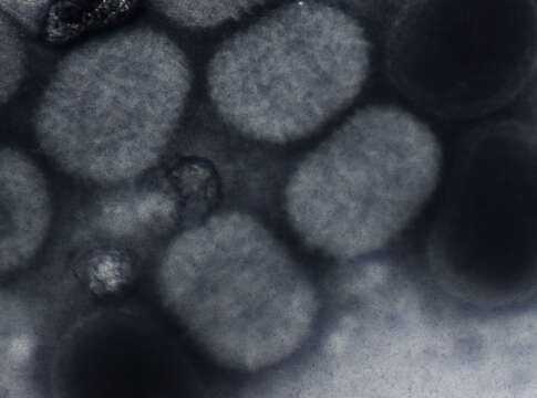 Image of Molluscum contagiosum virus