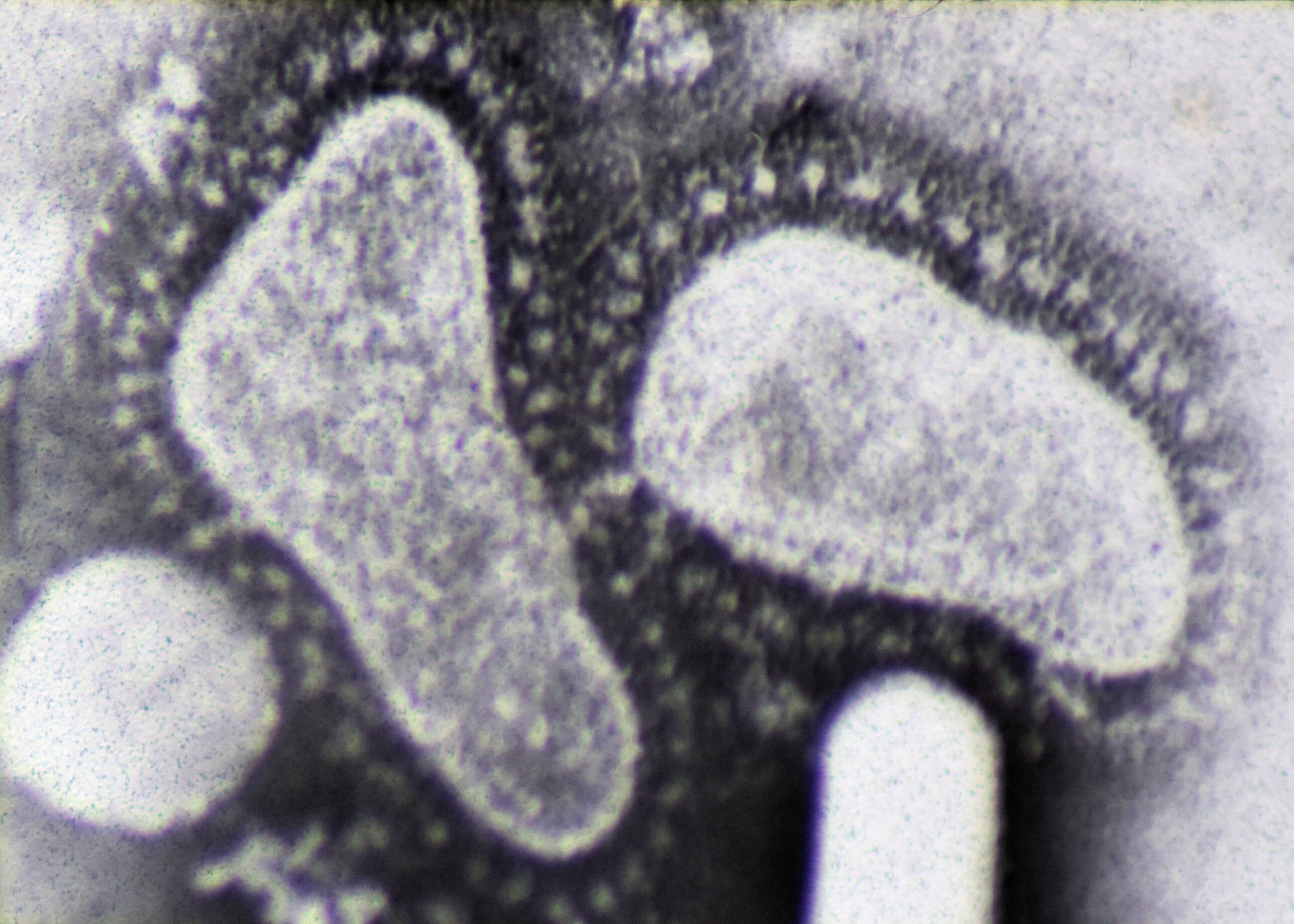 Sivun koronavirukset kuva