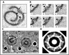 Image de Gemmata obscuriglobus