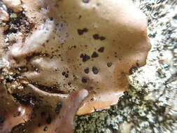 Image of navel lichen