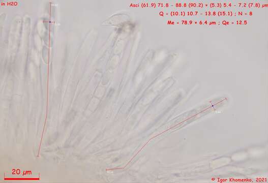 Image of Moellerodiscus capillipes (Quél.) M. P. Sharma 1986