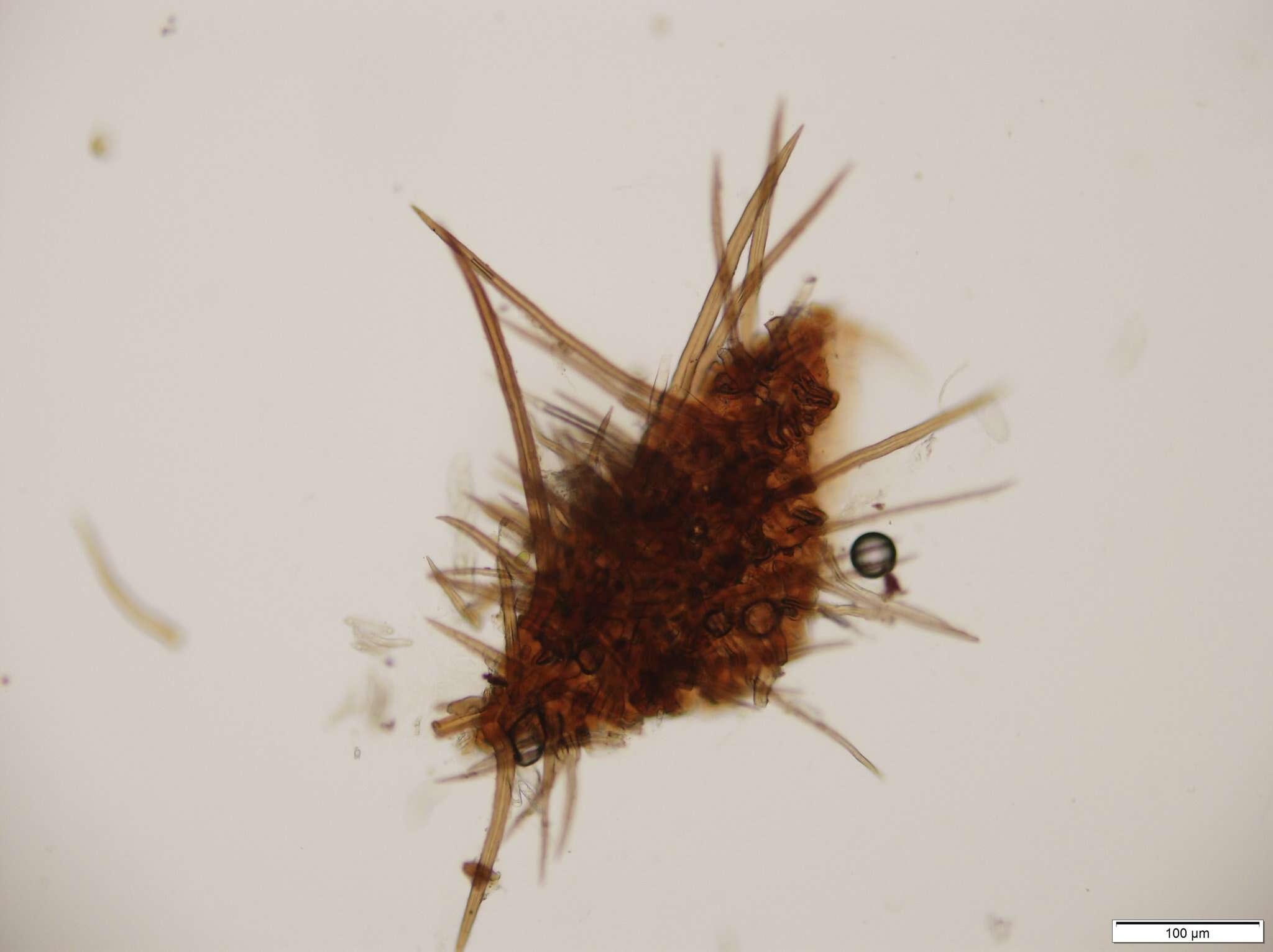 Echinosphaeria strigosa (Alb. & Schwein.) Declercq 2009的圖片