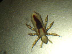 Image of head louse