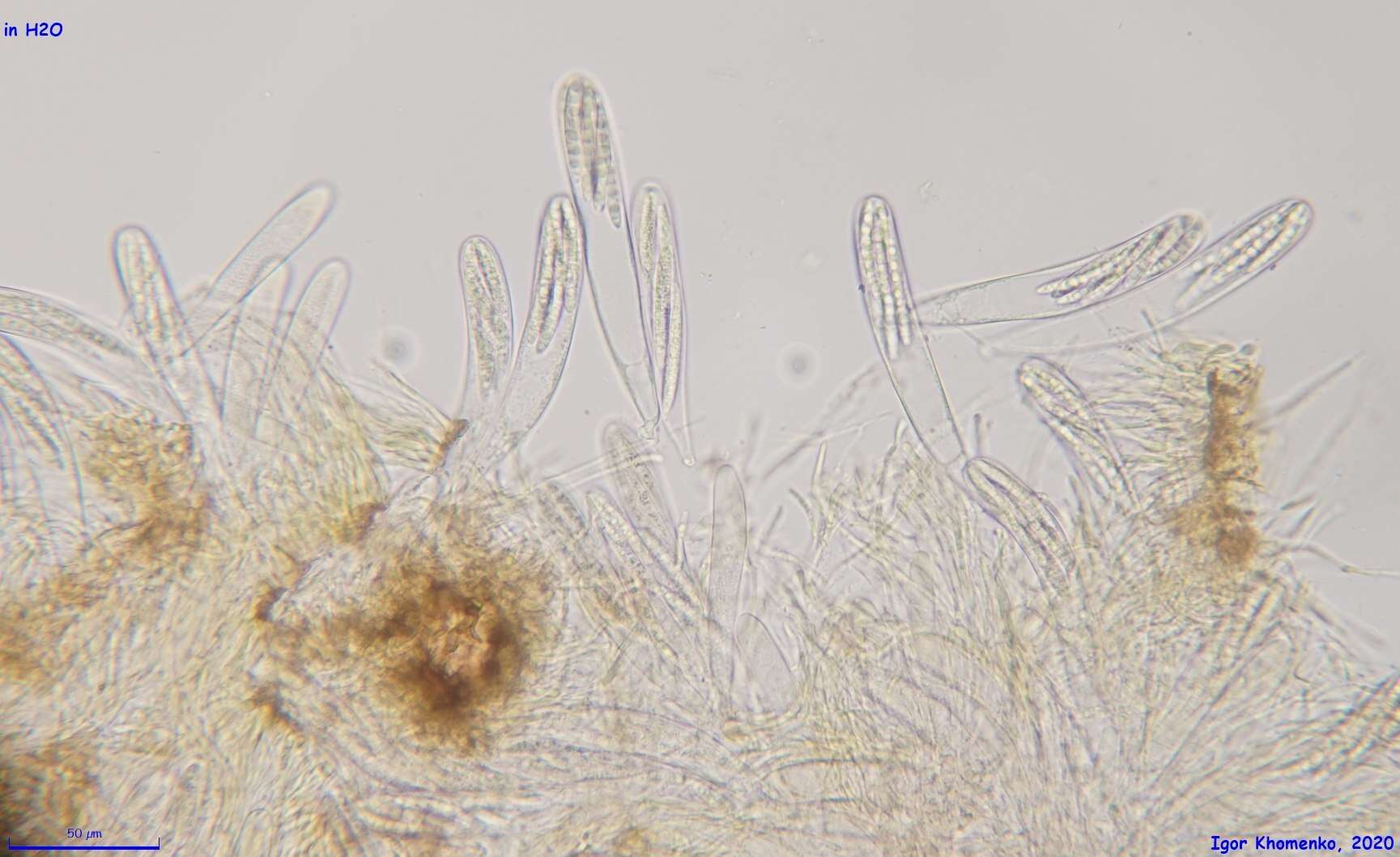 Image of Durella connivens (Fr.) Rehm 1881