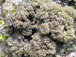 Image of skin lichen