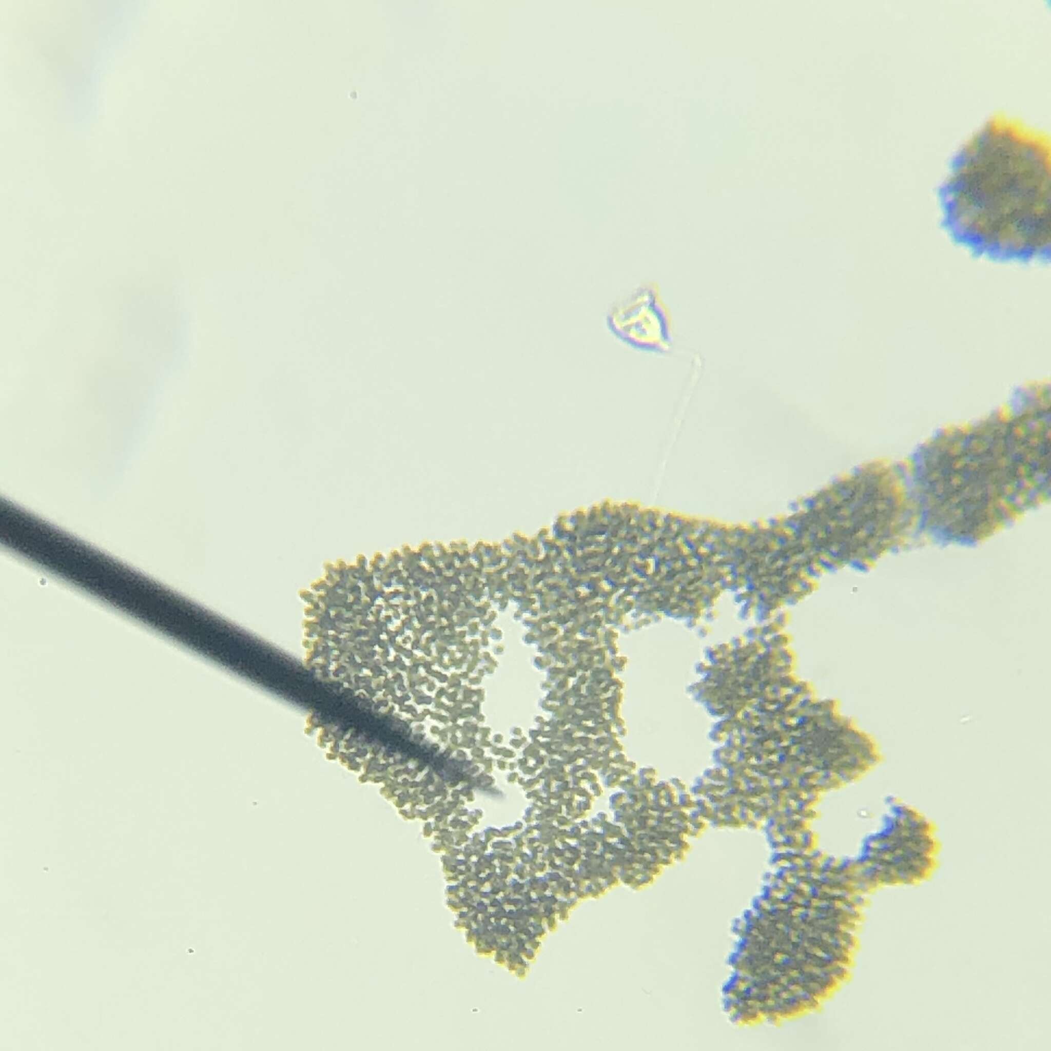 Image de <i>Microcystis <i>aeruginosa</i></i> subsp. aeruginosa