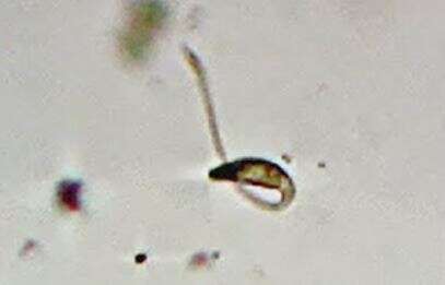 Image of Lacrymaria olor