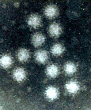 Image of Norovirus