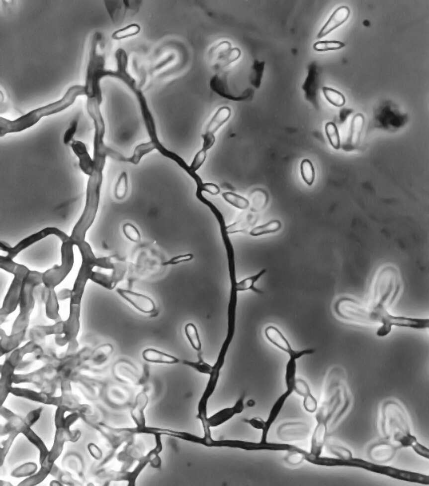 Image of Dothideomycetes