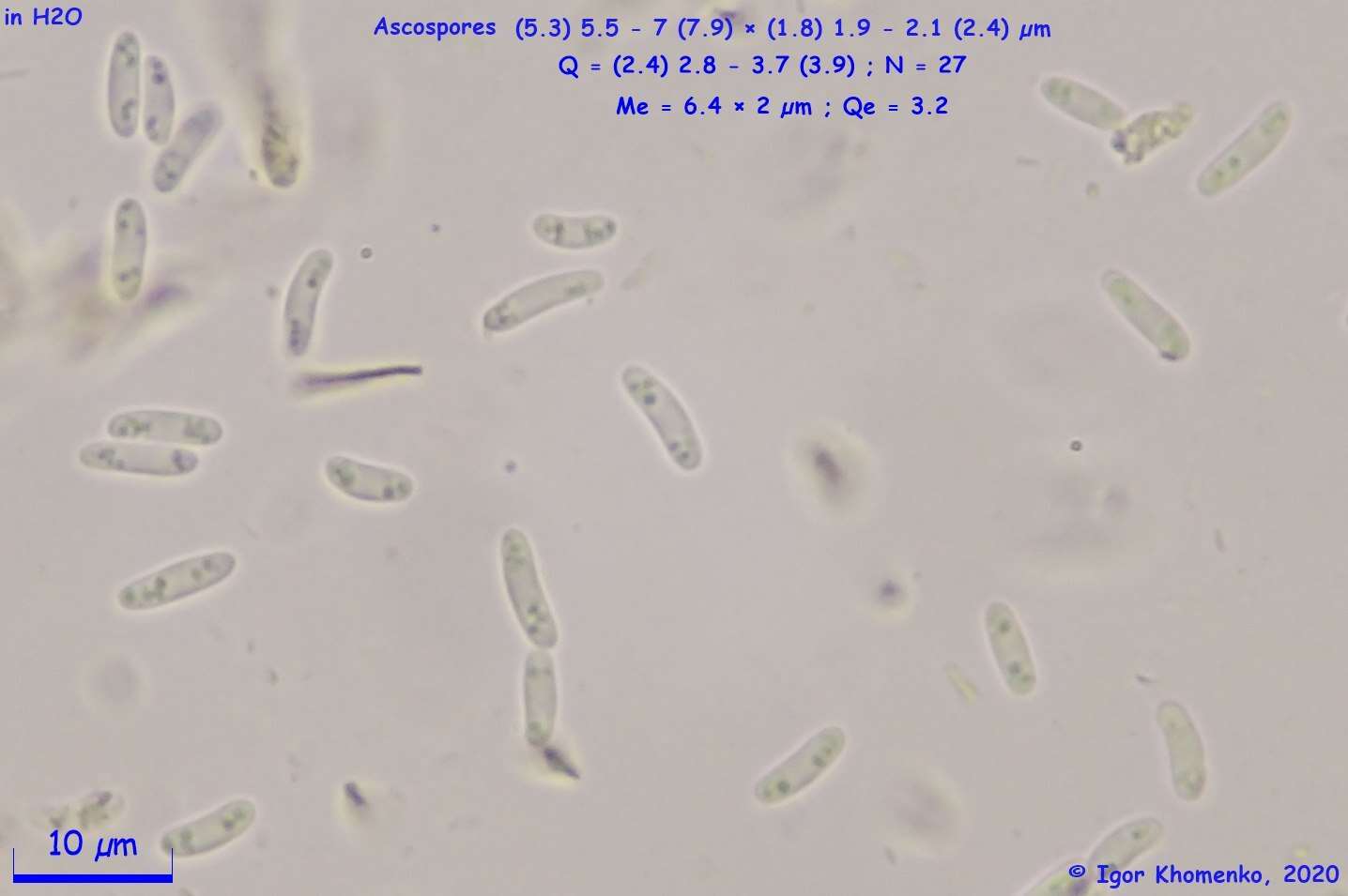 Image of Ionomidotis fulvotingens (Berk. & M. A. Curtis) E. K. Cash 1939