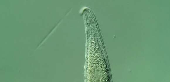 Image of Loxophyllum perihoplophorum