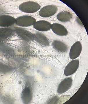 Image of Filamentous fungus