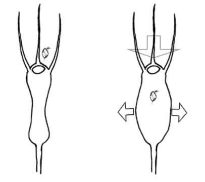 Image of Bladderworts