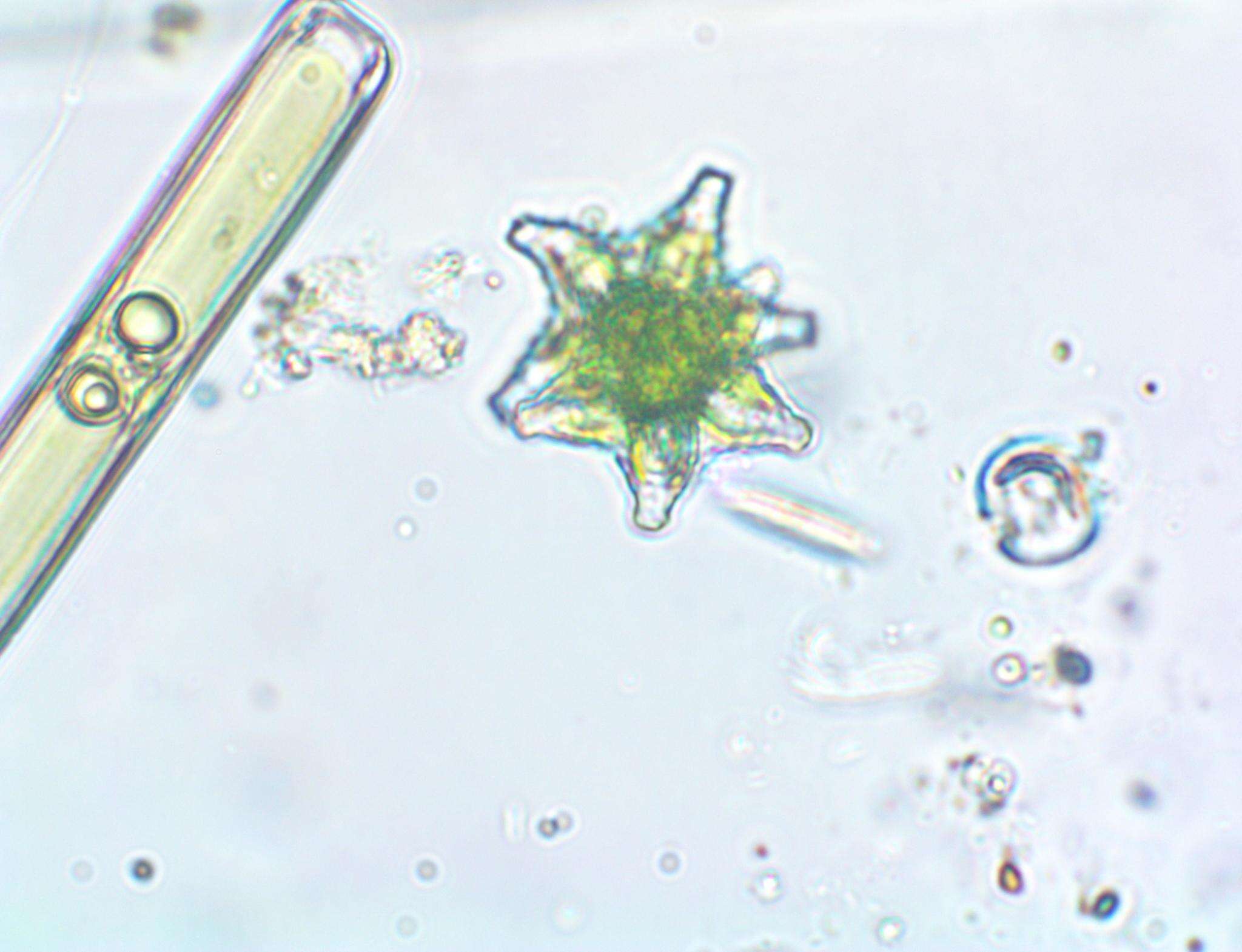 Image of Staurastrum margaritaceum