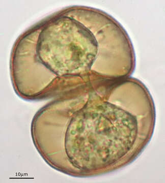 Image of Arcella hemisphaerica