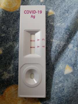 Severe acute respiratory syndrome-related coronavirus resmi