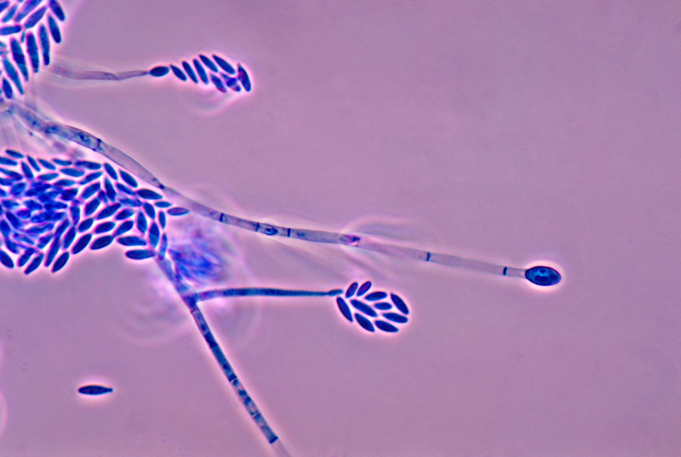 Image de Fusarium