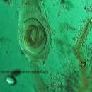 Trichinella spiralis (Owen 1835)的圖片