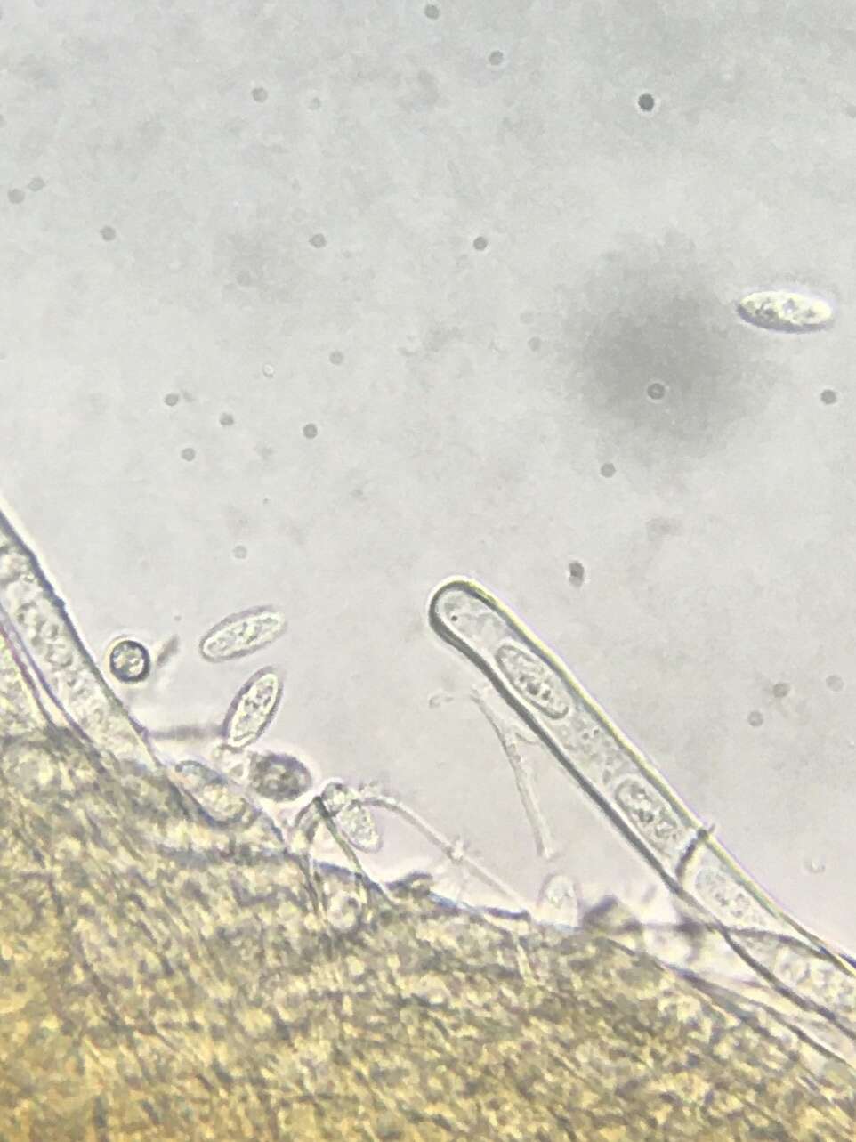 Image of Neournula nordmanensis Paden & Tylutki 1969