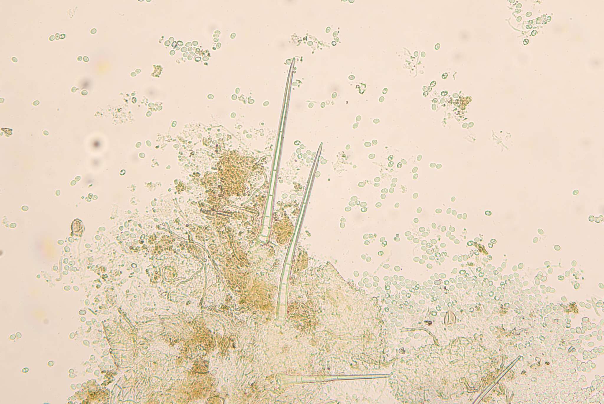 Image of Trichobolus zukalii (Heimerl) Kimbr. 1967