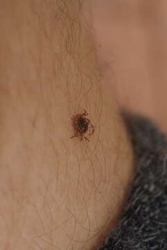 Image of Kangaroo tick