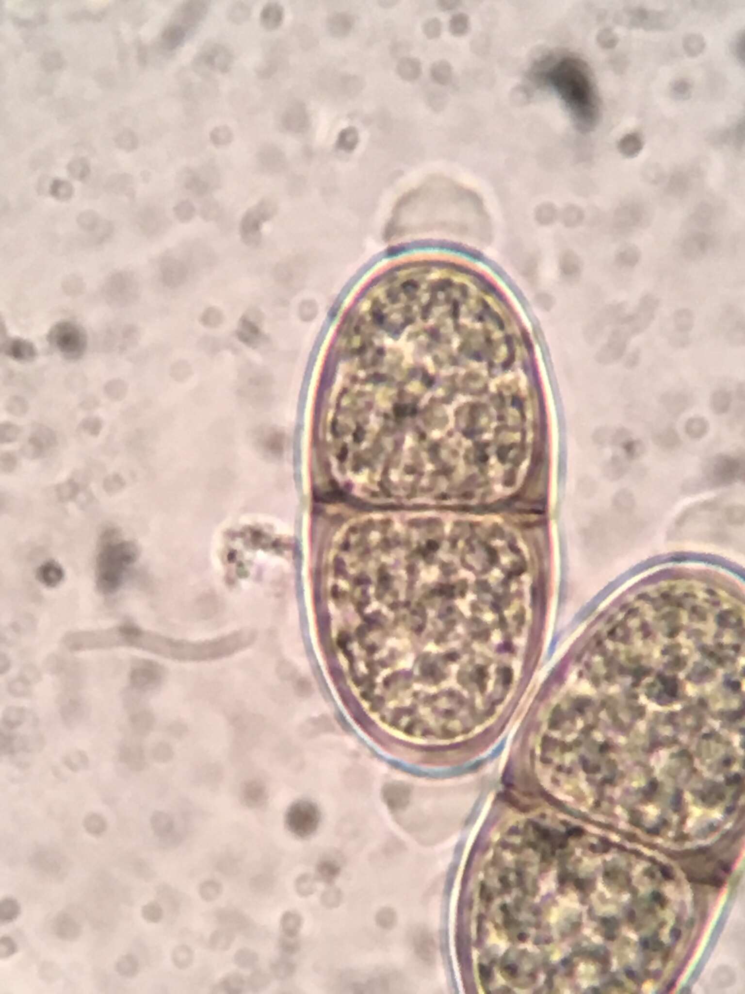 Imagem de Prosthecium appendiculatum (G. H. Otth) M. E. Barr 1978